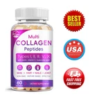 Collagen Peptides for Women & Men,Type I, II, III, V, X Multi Collagen Pills NEW