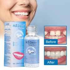 1/2/3/5X Tooth Repair Granules Temporary Kit Permanent Strong Teeth Tooth Repair