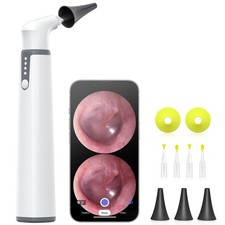 AnyScope Wireless Otoscope with Gyroscope, Ear Camera with Dual View, 3.9 mm ...