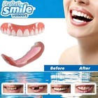 Snap On False Teeth Upper & Lower Dental Veneers Dentures Tooth Cover Set Soft*