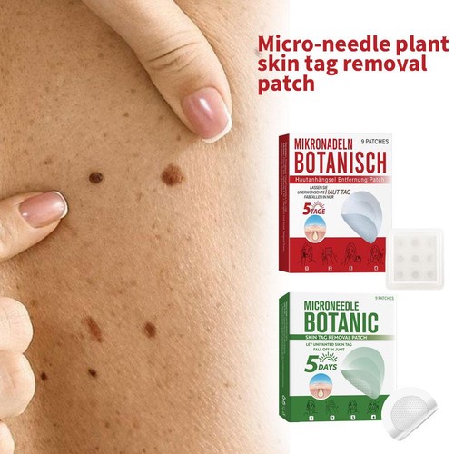 Microneedles Botanical Skin Tag Removal Patch - Quick Acting - 9pcs/Box - Picture 4 of 23
