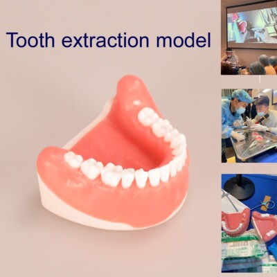 Dental Tooth Extraction Practice Model Dental Training Product