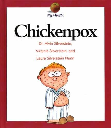 Chickenpox (My - Library Binding, by Silverstein Alvin; Silverstein - Acceptable