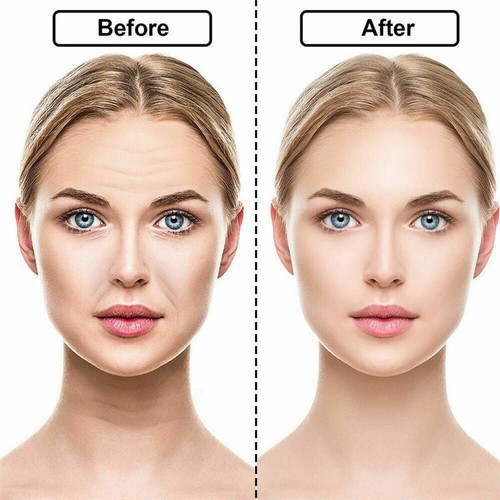 16Pack Silicone Face Pad Patches Woman Anti Wrinkle Regain Firmness Tool A - Picture 8 of 13