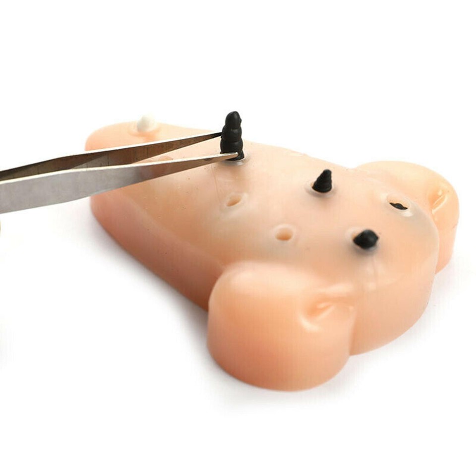 Acne Toy Recycled Blackhead Pimple Squeeze Stress Relief Remover Stop