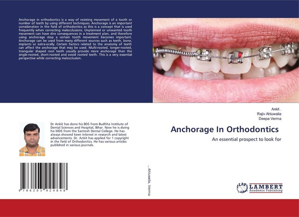 Anchorage In Orthodontics Ankit-image