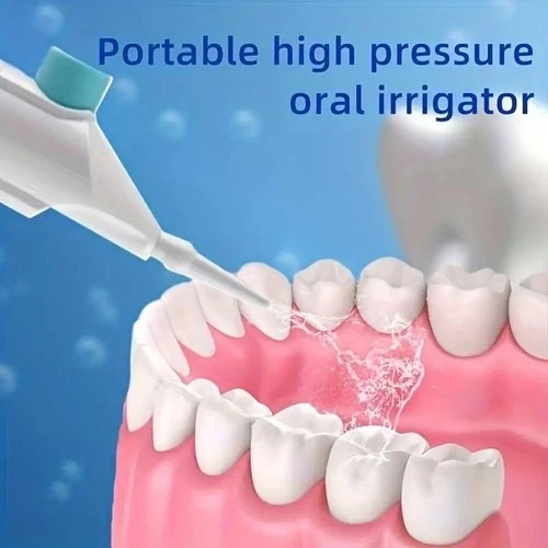 Household High Pressure Oral Irrigator Portable Teeth Clean Water Dental Floss - Picture 3 of 12