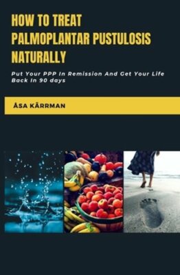 How To Treat Palmoplantar Pustulosis Naturally: Put Your PPP In Remission And