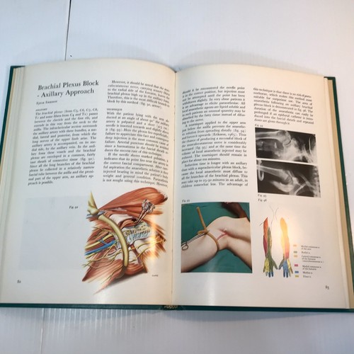 Anesthesia Books Lot of 3 Vintage 1980s Hardcovers General, Children, Local - Picture 23 of 24
