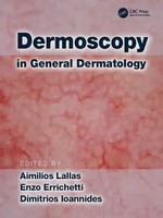 Aimilios Lallas (U. A.) | Dermoscopy In General Dermatology | Buch | Englisch