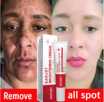 Whitening Freckles Face Cream Removal Melasma Dark Spots Corrector Lighten Melan