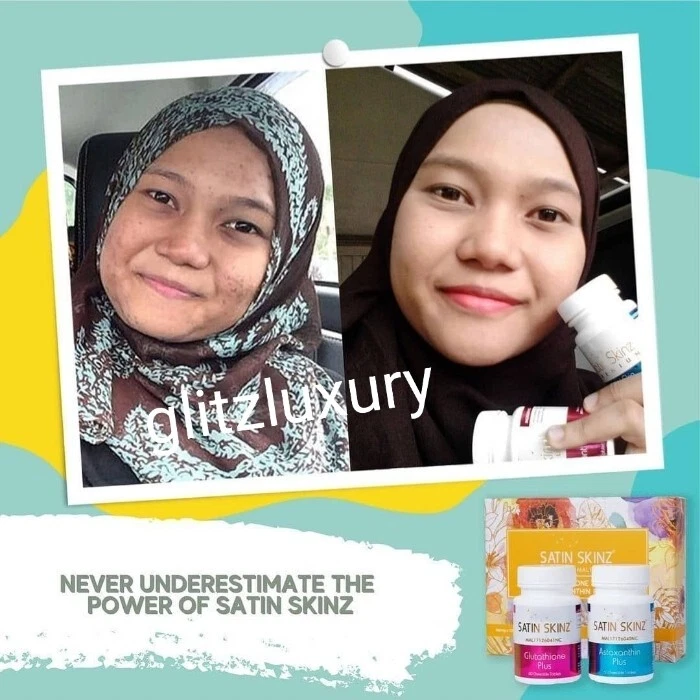 Satin Skinz Duo pack gluta tabs skin whitening supplement. 2 in a box👌👌 - Image 4 of 4