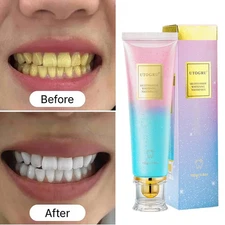 Niacinamide Whitening Toothpaste,Natural Niacinamide Toothpaste,Teeth Whitening
