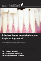 Farah Shaikh (U. A.) | Injertos óSeos En Periodoncia E ImplantologíA Oral | Buch