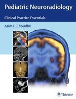 Asim F Choudhri | Pediatric Neuroradiology | Buch | Englisch (2016) | 288 S.