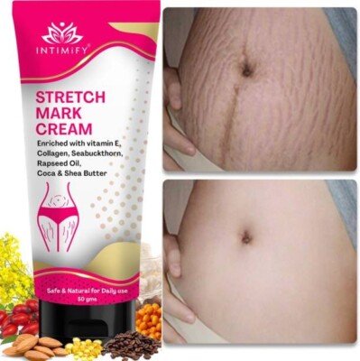 INTIMIFY Stretch Marks Removal Cream, Reduce Scar Before & After Pregnancy 50g