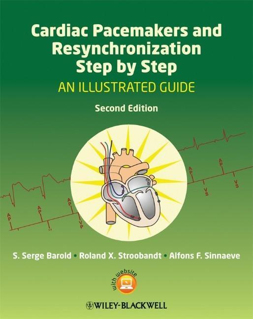 Thumbnail - Cardiac Pacemakers And Resynchronization Therapy Step-by-step |