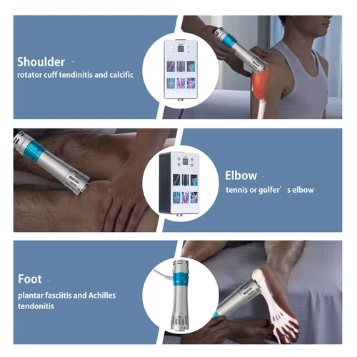 ED Shockwave Therapy Machine terapia con onde d'urto professionali ED extracorporee - Foto 16 di 23
