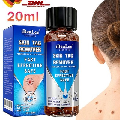Warzenentferner Warzenmittel Warze Papillome Skin Tag Remover Hornhaut 20ML DHL