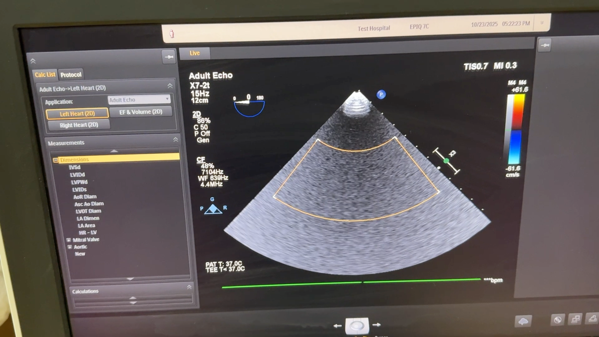 PHILIPS TEE Ultrasound Probe X7-2T Transducer Compact Connector