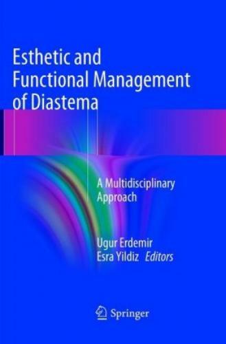 Thumbnail - Esthetic And Functional Management Of Diastema A Multidisciplinary