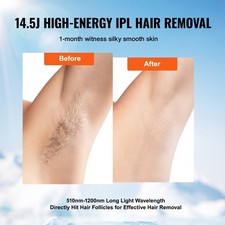 IPL Hair Removal Device with Sapphire Ice Cooling 5 Levels for Body Face at Home