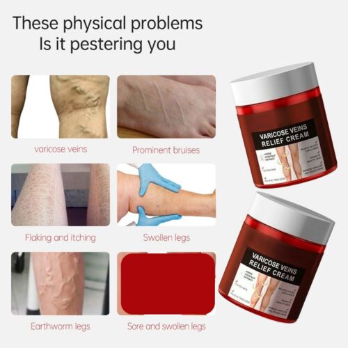 Treatment Legs Varicose Veins Cream Vein Care Fading Cream Herbal Ointment - Picture 6 of 11