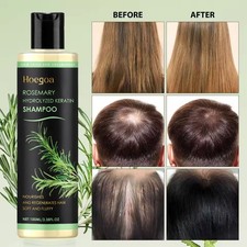 HOEGOA Rosemary Hair Growth Shampoo Hydrolyzed Keratin Shampoo for Thinning Hair