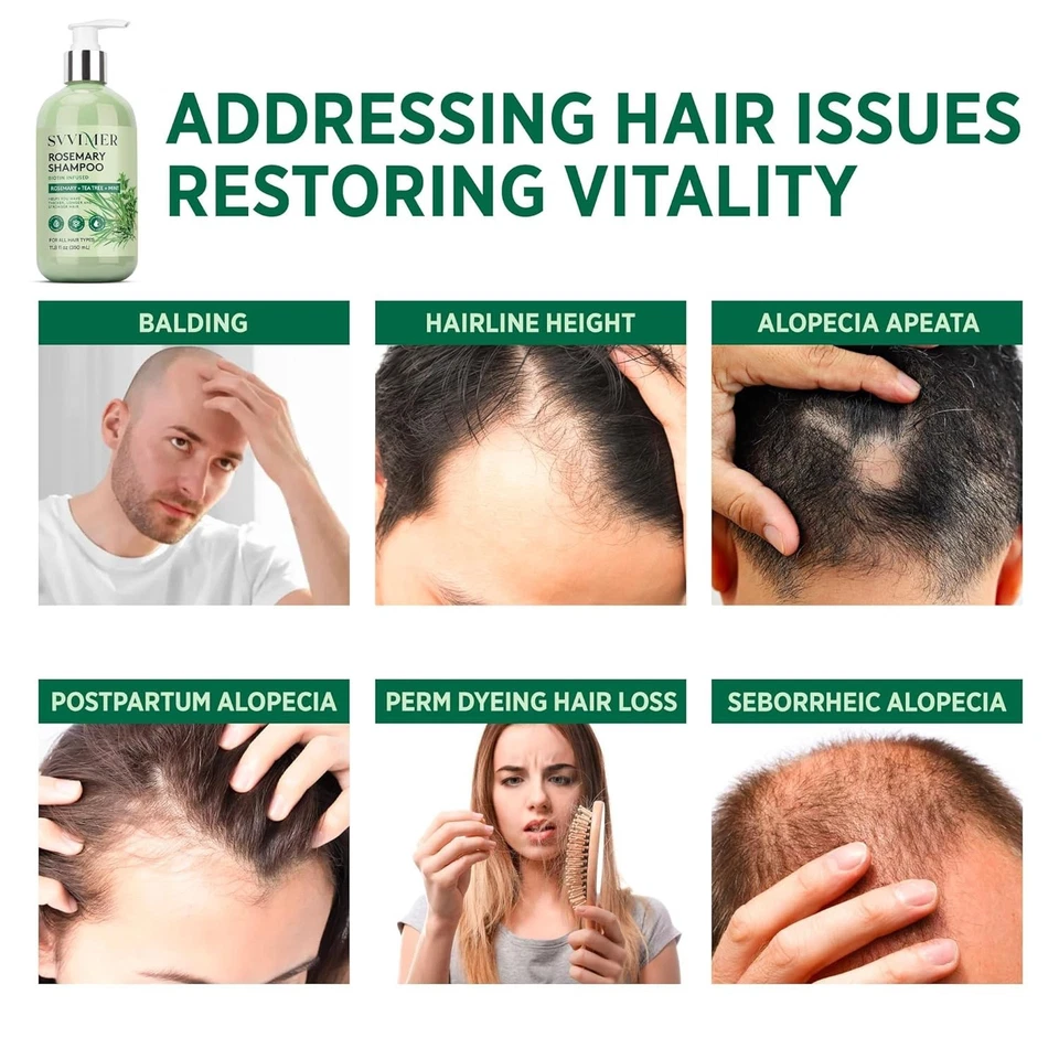 Rosemary Hair Growth Shampoo: Thickening and Regrowth Formula for Men & Women... - Image 4 of 4