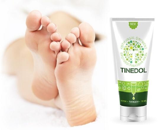Tinedol Creme für Haut Beine gegen Nagelpilz und Geruch.
