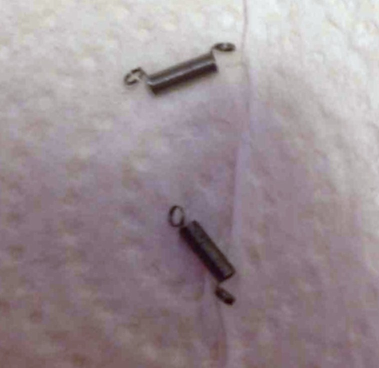 Barra Guida YMYNY E 4 Catene Per Motosega, 52 Maglie Di Trasmissione, Passo 3/8", Calibro 0,05 - Foto 13