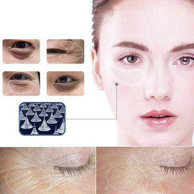 Soluble Tiny needle Eye Patch Firming Tiny crystalline Eye Mask Lifting