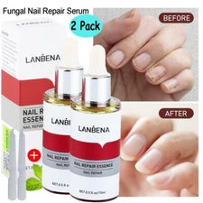 2PCS LANBENA Fungal Nail Repair Essence Serum + Nail File Hand & Foot Treatment