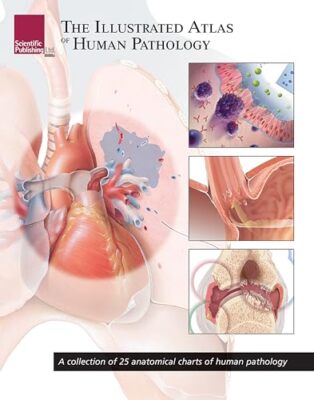 Illustrated Atlas of Human Pathology: A Collection of 25 Anatomical Charts of...