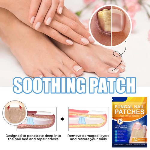 Nighttime Renewal Fungal Nail Patches - 32 Patch - Overnight Nail Repair - Imagen 4 de 11