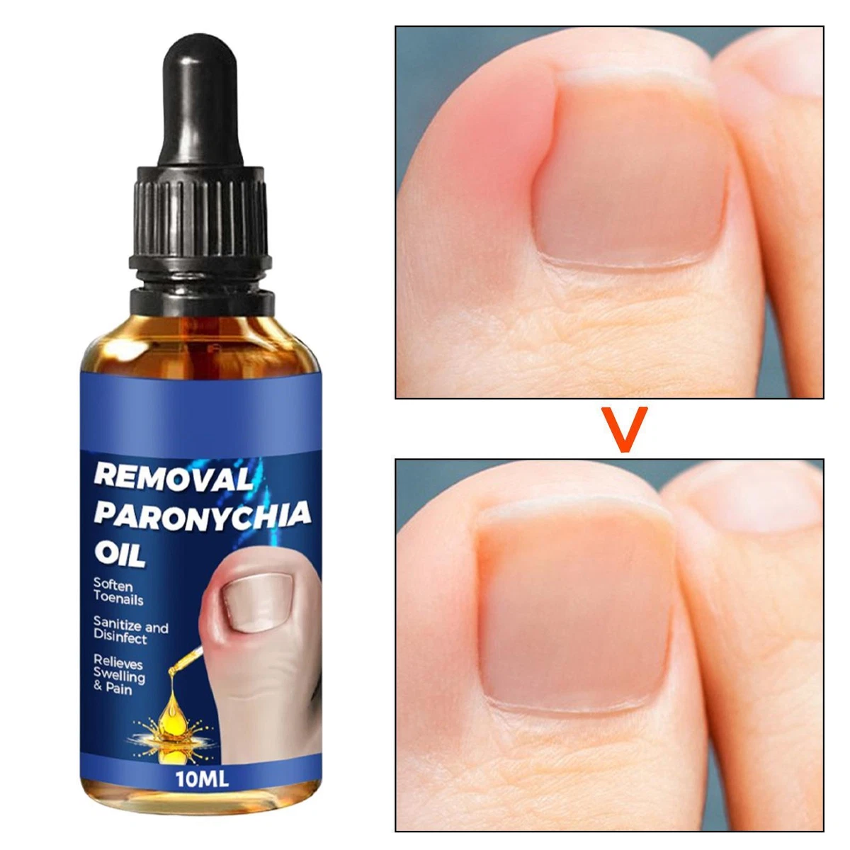 What do you do when your nail splits down the middle? - Quora