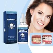 60ml Dental Cavity Healing Tooth Armor Teeth Care Whitening Enamel Restoration