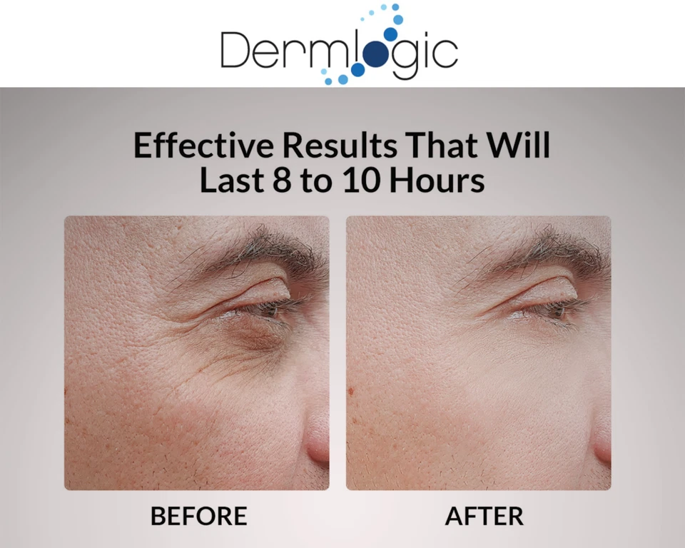 Under Eye Puffiness & Dark Circles Rapid Treatment- Instantly Reduces Puffy Eye - Image 4 of 4