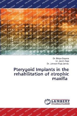 Pterygoid Implants in the rehabilitation of atrophic maxilla by Dr Bibiya Dayana