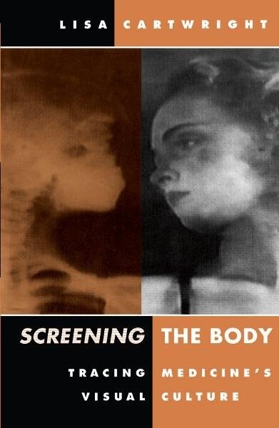 Screening The Body – Tracing Medicine′s Visual Culture Cartwright Paperback