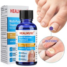 Antibacterial Fungal Nail Treatment Nail Repair Essential Oil Serum Nail Care