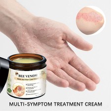 Bee Venom All-In-One Cream Skin Treatment 2025 Professional Bee Venom Cream