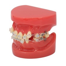 Orthodontic Demonstration Model With Bracket For Dental Education