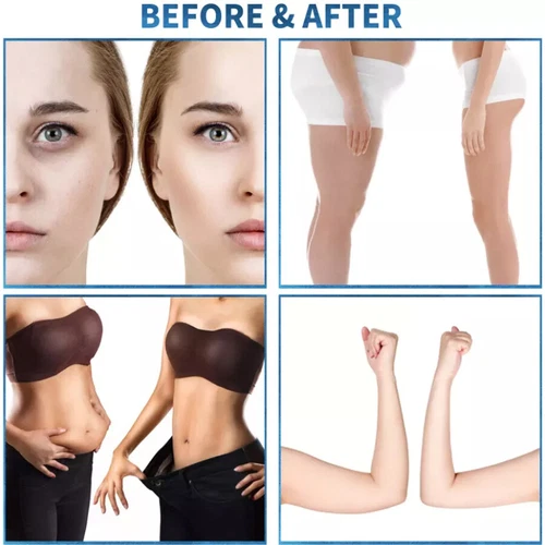 2In1 Endosphere Body Massage Lymphatic Drainage Anti-Cellulite Slimming Machine - Picture 5 of 11