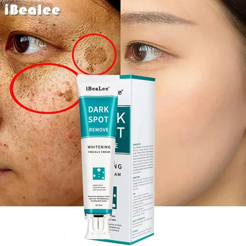 Cream which remove dark cheap spots