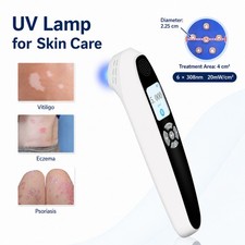 308nm Excimer UVB Light Therapy for Skin Tone Evenness Dark Spot Care 20mW