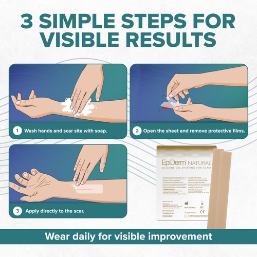Biodermis Epiderm Long Strips Natural Silicone Scar Sheets Soft Flexible - Afbeelding 8 van 8