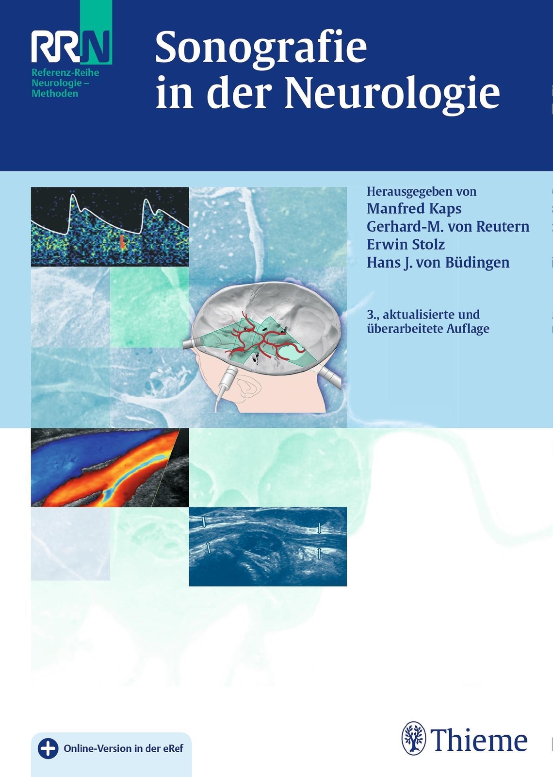 Thumbnail - Sonografie In Der Neurologie | Manfred Kaps (u. A.) | Deutsch | Bundle