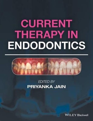Current Therapy in Endodontics by Priyanka Jain (English) Hardcover Book