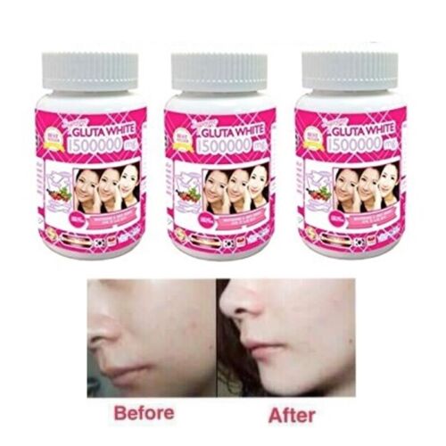 White Gluta Supreme 1500000 Mg V Shape Face Whitening Anti Aging 3x30 Softgels - Picture 2 of 5